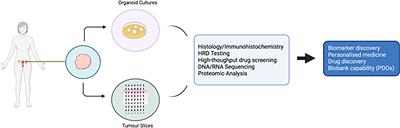 Novel Ex Vivo Models of Epithelial Ovarian Cancer: The Future of Biomarker and Therapeutic Research